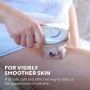 HoMedics Smoothee - Massaggiatore Anti Cellulite ad aspirazione per pelle liscia, Disintossica la pelle, Riduce la buccia d'aran